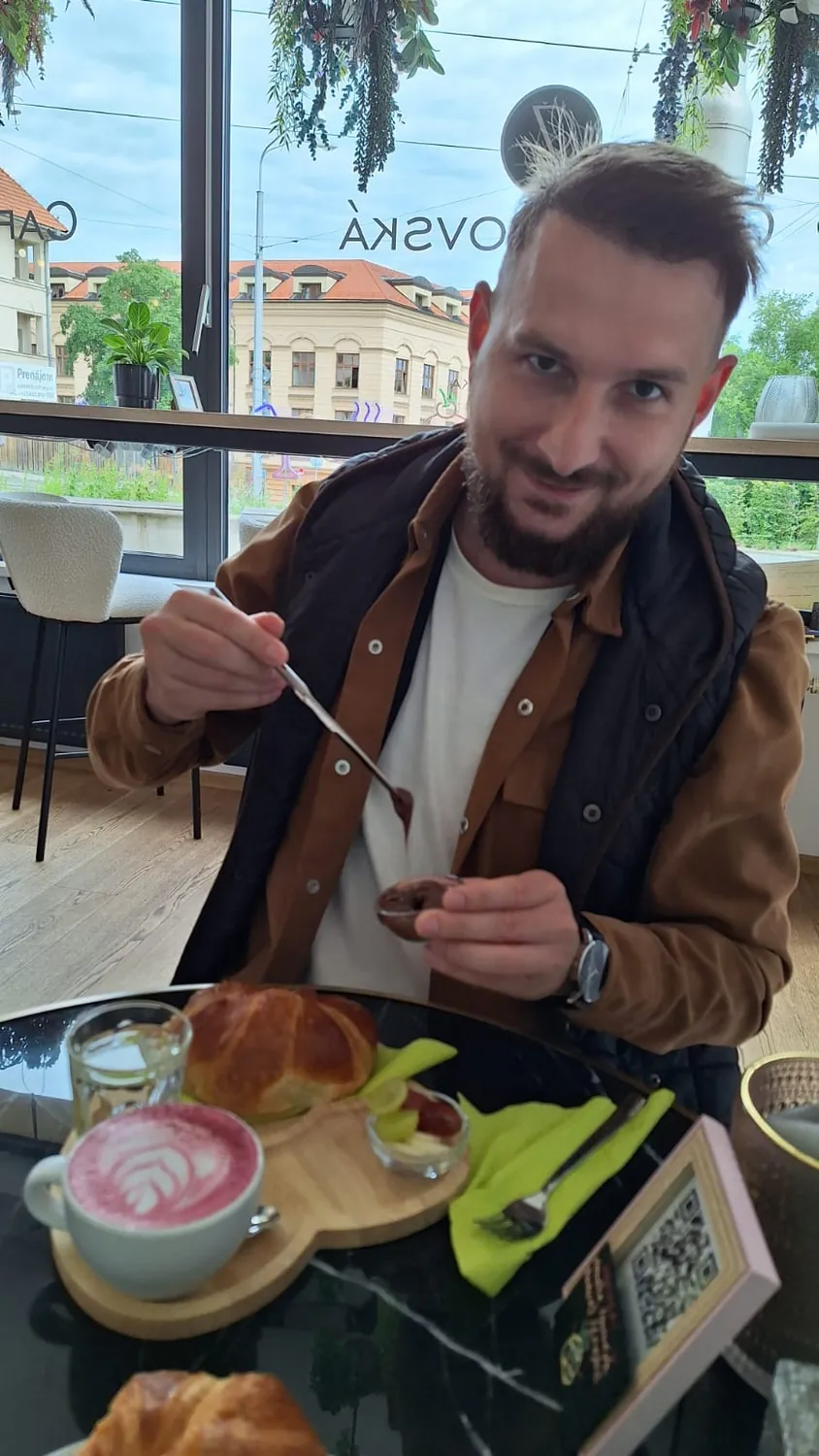 Ten istý klient po transplantácii vlasov